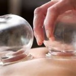 cupping2